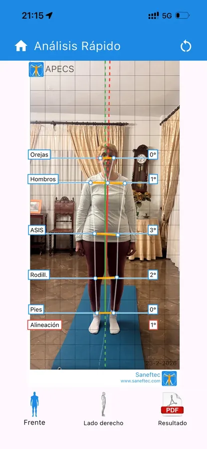 Valoración postural en casa de un cliente antes de empezar la readaptación